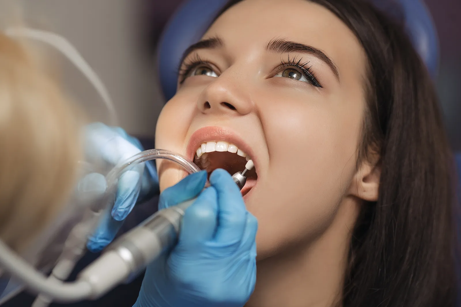 Root Canal Aftercare: Essential Tips for a Smooth Recovery and Long-Term Success — article cover