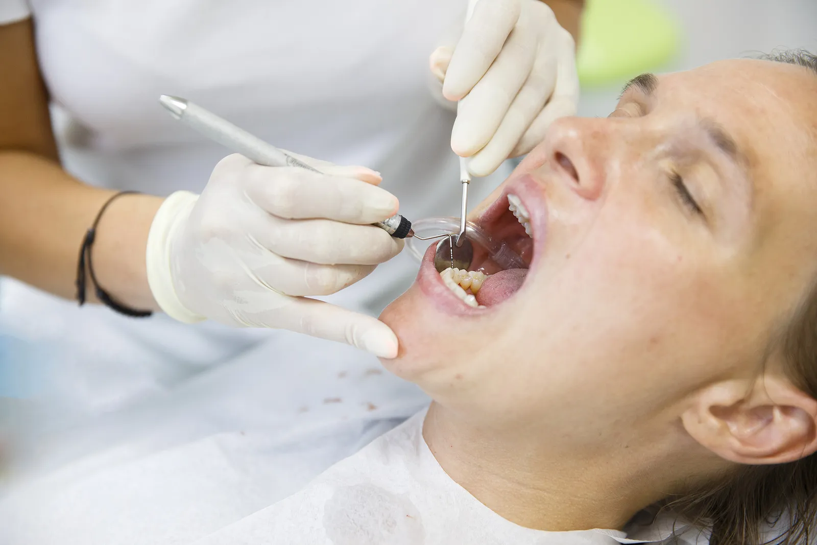 What to Expect After a Root Canal: Common Symptoms and When to Seek Help — article cover