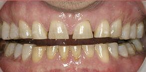 ToothDocs smile gallery case 7 — before treatment