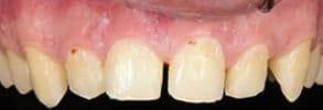 ToothDocs smile gallery case 8 — before treatment