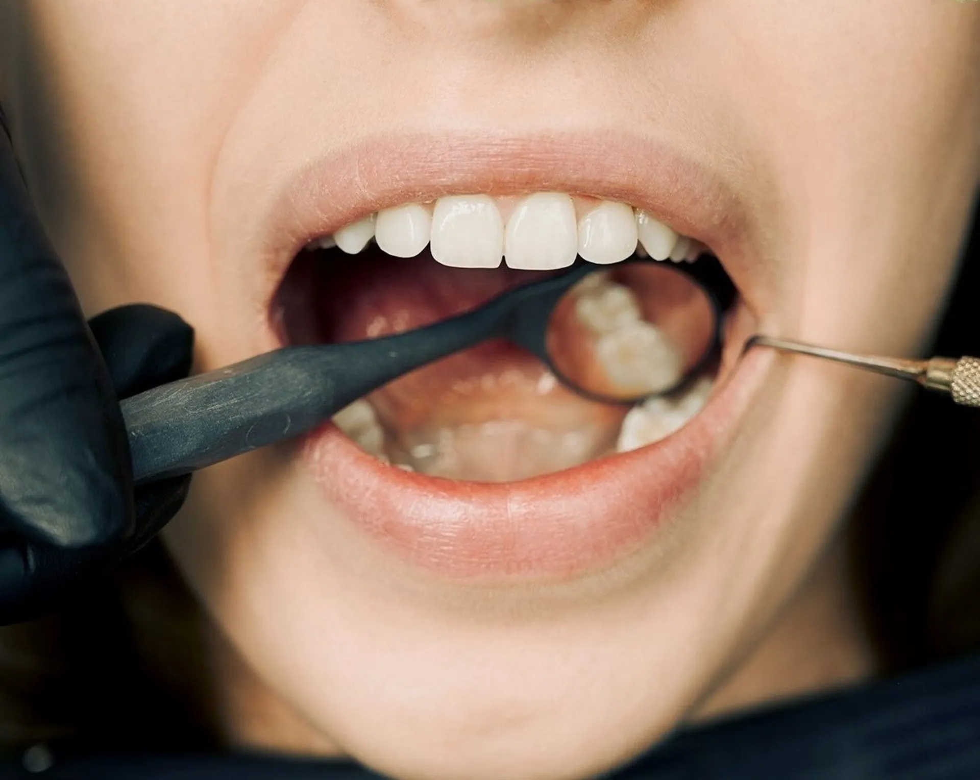 The Benefits of Gum Disease Treatment — article cover