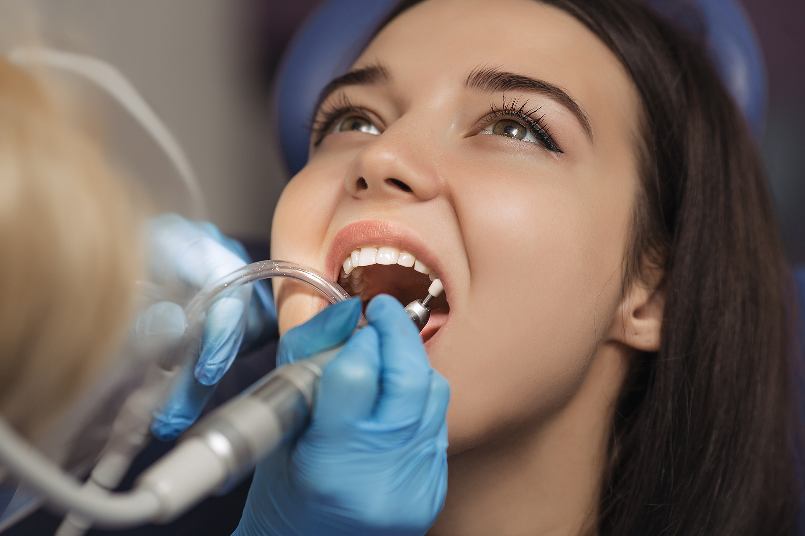 Root Canal Aftercare: Essential Tips for a Smooth Recovery and Long-Term Success