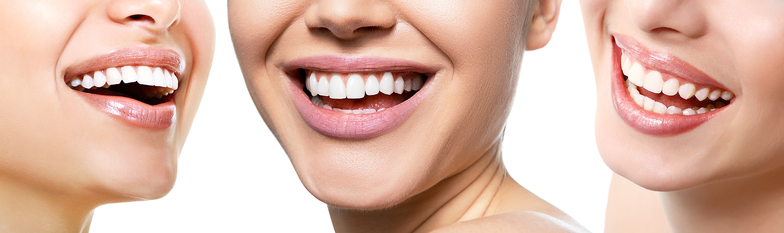 Achieve a Radiant Smile with Professional Teeth Whitening in New York, NY